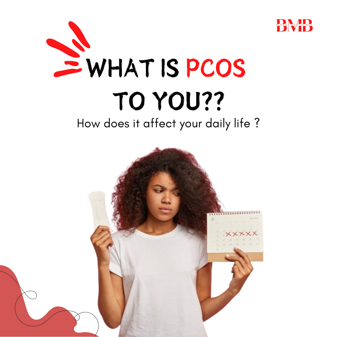 PCOS: MYTHS AND FACTS
